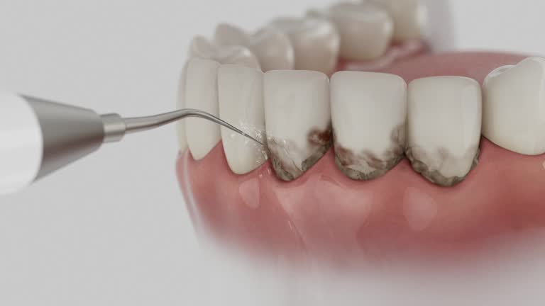 Trusted Teeth Cleaning And Checkup service in Preston, MN - Dentist Open Now